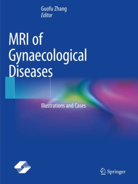 MRI of Gynaecological Diseases