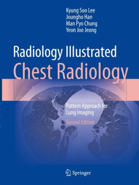 Radiology Illustrated: Chest Radiology
